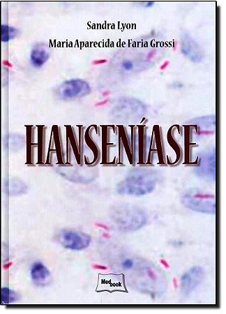 Livro Hanseníase - Lyon - Medbook