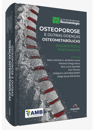 Livro Osteoporose e Outras Doenças Osteometabólicas AMB