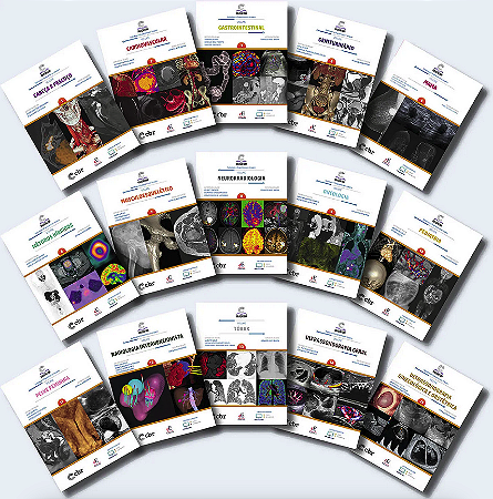 Livros Coleção CBR 15 Volumes Colégio Brasileiro de Radiologia