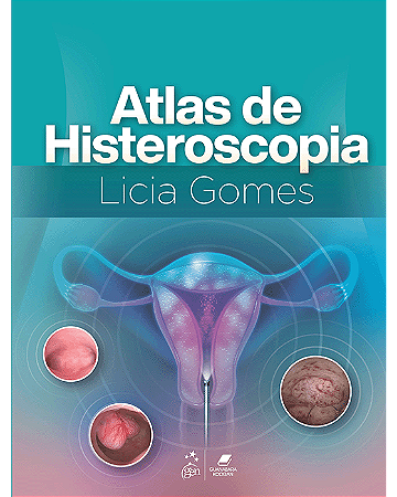 Livro Atlas de Histeroscopia  Gomes
