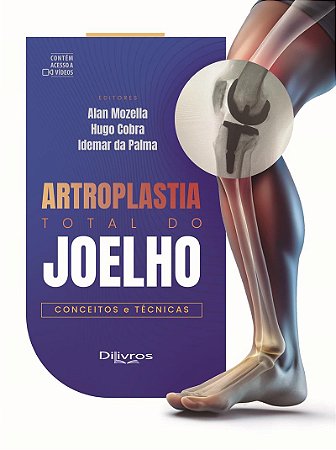 Livro Artroplastia Total do Joelho -Conceitos e Técnicas