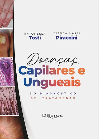 Livro Doenças Capilares e Ungueais Do Diagnóstico ao Tratamento