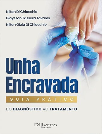 Livro Unha Encravada: Guia Prático  Do Diagnóstico ao Tratamento