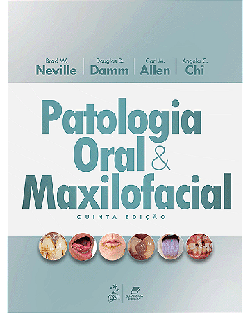 Livro Neville Patologia Oral e Maxilofacial