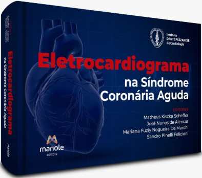 Livro ECG na Síndrome Coronária Aguda Dante Pazanese