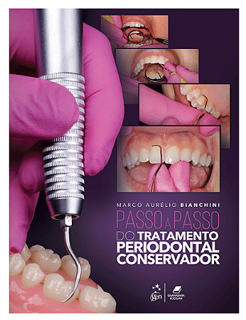 Livro Passo a Passo Tratamento Periodontal Conservador