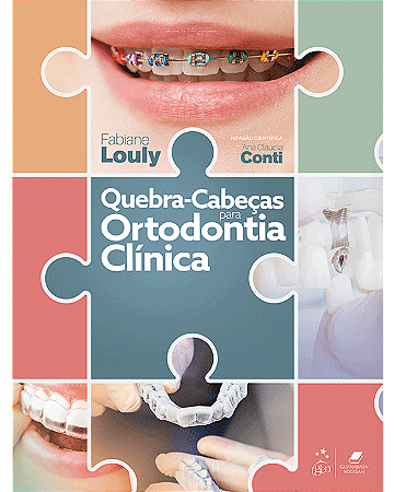 Livro Quebra-Cabeças Para Ortodontia Clínica