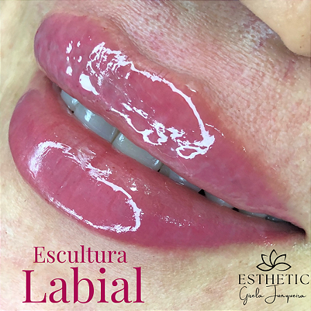 Preenchimento labial