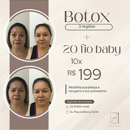 Botox