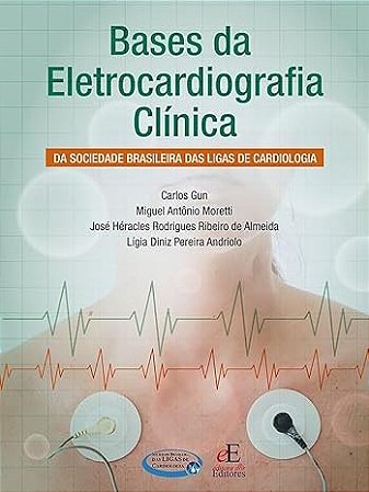 Bases da Eletrocardiografia Clinica