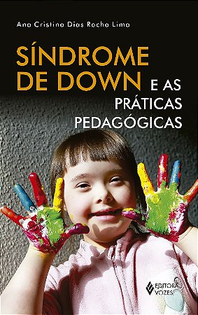 Sindrome de Down e as Praticas Pedagogicas