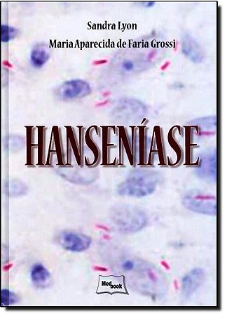 Hanseniase