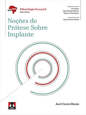 Nocoes de Protese sobre Implante