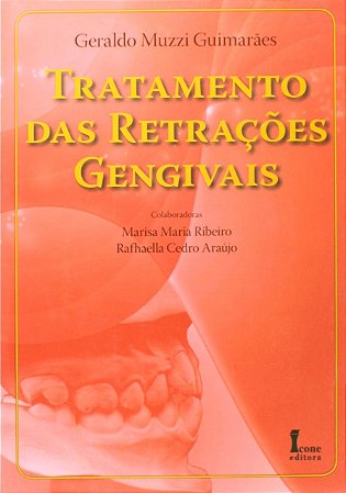Tratamento das Retracoes Gengivais