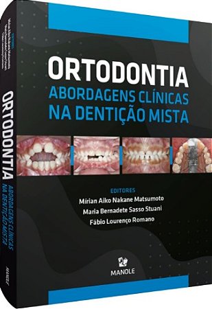 Ortodontia: Abordagens Clinicas na Denticao Mista