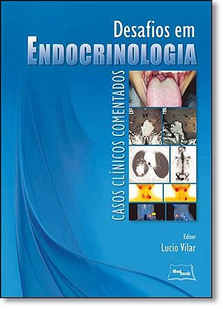 Desafio em Endocrinologia  - Casos Clinicos Comentados