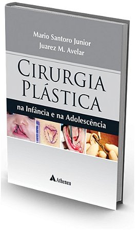 Cirurgia Plastica na Infancia e na Adolescencia