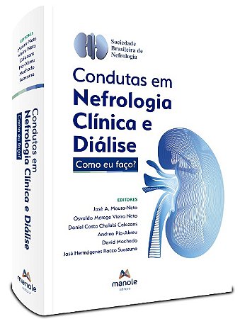Condutas em Nefrologia Clinica e Dialise: Como Eu Faco