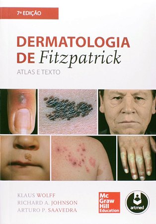 Dermatologia de Fitzpatrick - Atlas e Texto