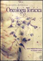 Conceitos e Rotinas em Oncologia Toracica