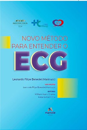 Novo Metodo para Entender o Ecg