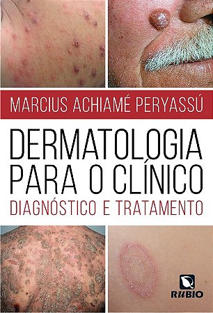 Dermatologia para o Clinico: Diagnostico e Tratamento