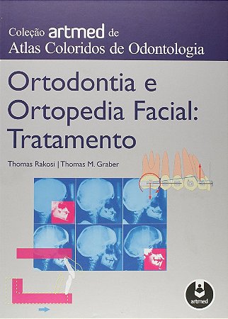 Ortodontia e Ortopedia Facial: Tratamento