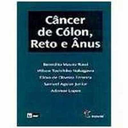 Cancer de Colon, Reto e Anus