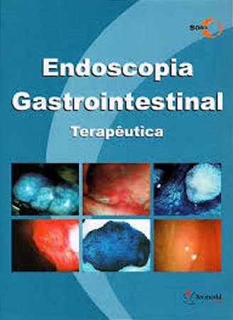 Endoscopia Gastrointestinal Terapeutica - Sobed