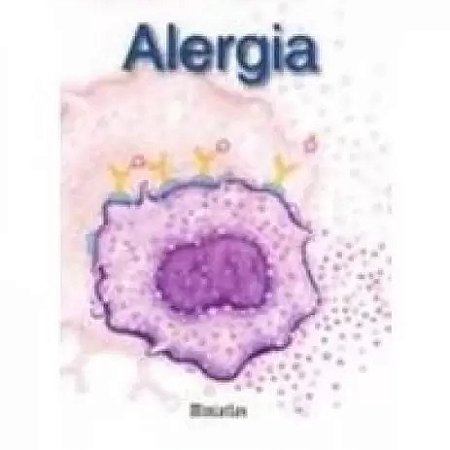 Miniatlas - Alergia