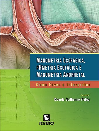 Manometria Esofagica, Phmetria Esofagica e Manometria Anorretal: Como Fazer