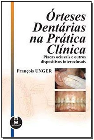 Orteses Dentarias Na Pratica Clinica