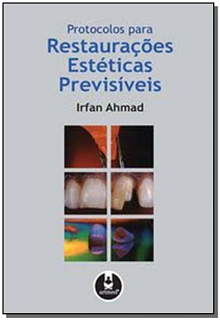 Protocolos Para Restauracoes Esteticas Previsiveis