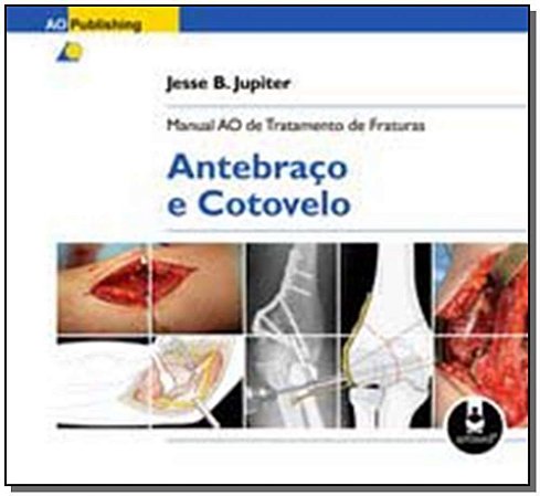 Manual Ao De Tratamento De Fraturas