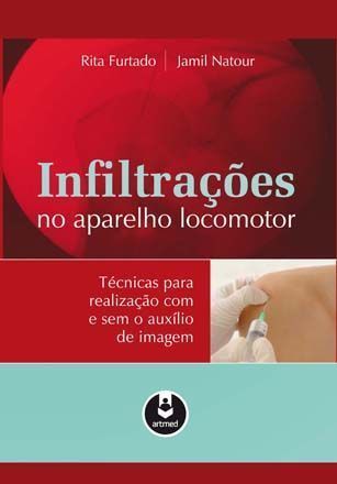 Infiltrações Do Aparelho Locomotor - Técnicas Para Realização Com E Sem O Auxílio De Imagem