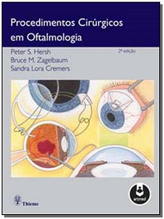 Procedimentos Cirúrgicos Em Oftalmologia - 02Ed/11