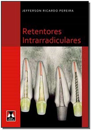 Retentores Intrarradiculares