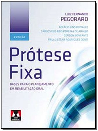 Prótese Fixa