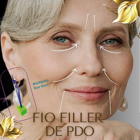 FIO FILLER DE PDO - 1 unidade - PROMOÇÃO BLACK FRIDAY