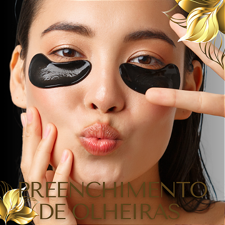 PREENCHIMENTO DE OLHEIRAS - 1 ml de ácido hialurônico - PROMOÇÃO BLACK FRIDAY