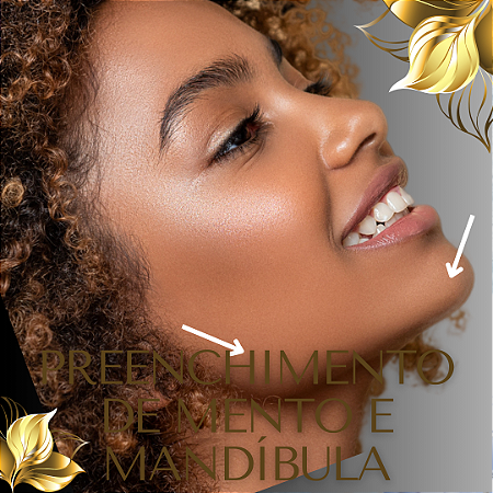 PREENCHIMENTO DE MENTO - 1 ml de ácido hialurônico - PROMOÇÃO