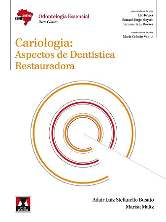 Cariologia: Aspectos de Dentística