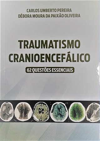 Traumatismo Cranioencefálico: 62 Questões Essenciais
