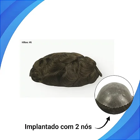 Protese capilar micro pele Hilton 20X25 COR: 6