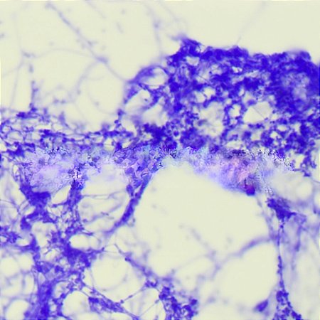 LAMINAS PREPARADAS DE BACTERIAS HUMANAS (CONJUNTO COM 30 LAMINAS)