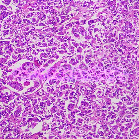 LAMINAS PREPARADAS DE PATOLOGIA HUMANA (CONJUNTO COM 50 LAMINAS)