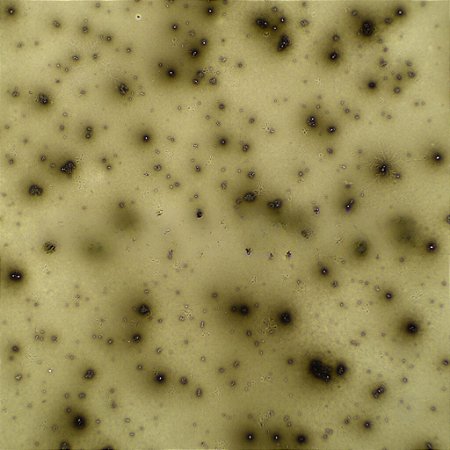 LAMINAS PREPARADAS DE MICROBIOLOGIA (CONJUNTO COM 25 LAMINAS)