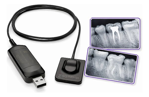Sensor Digital Vivant Intraoral DS2 - Schuster