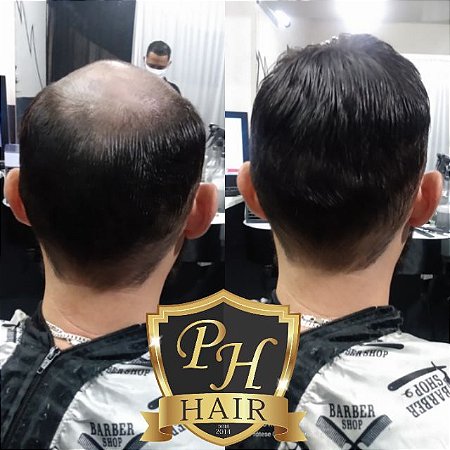 Prótese Capilar de Micro pele de Silicone 6 mm 1B