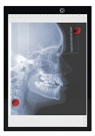 Negatoscópio 1 Corpo Led Médico Panorâmico Portátil Mesa A4
